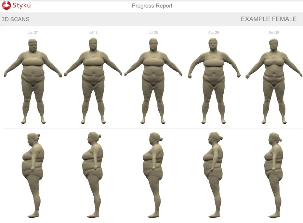 Example 3D body scan progress report showing body changes over multiple months