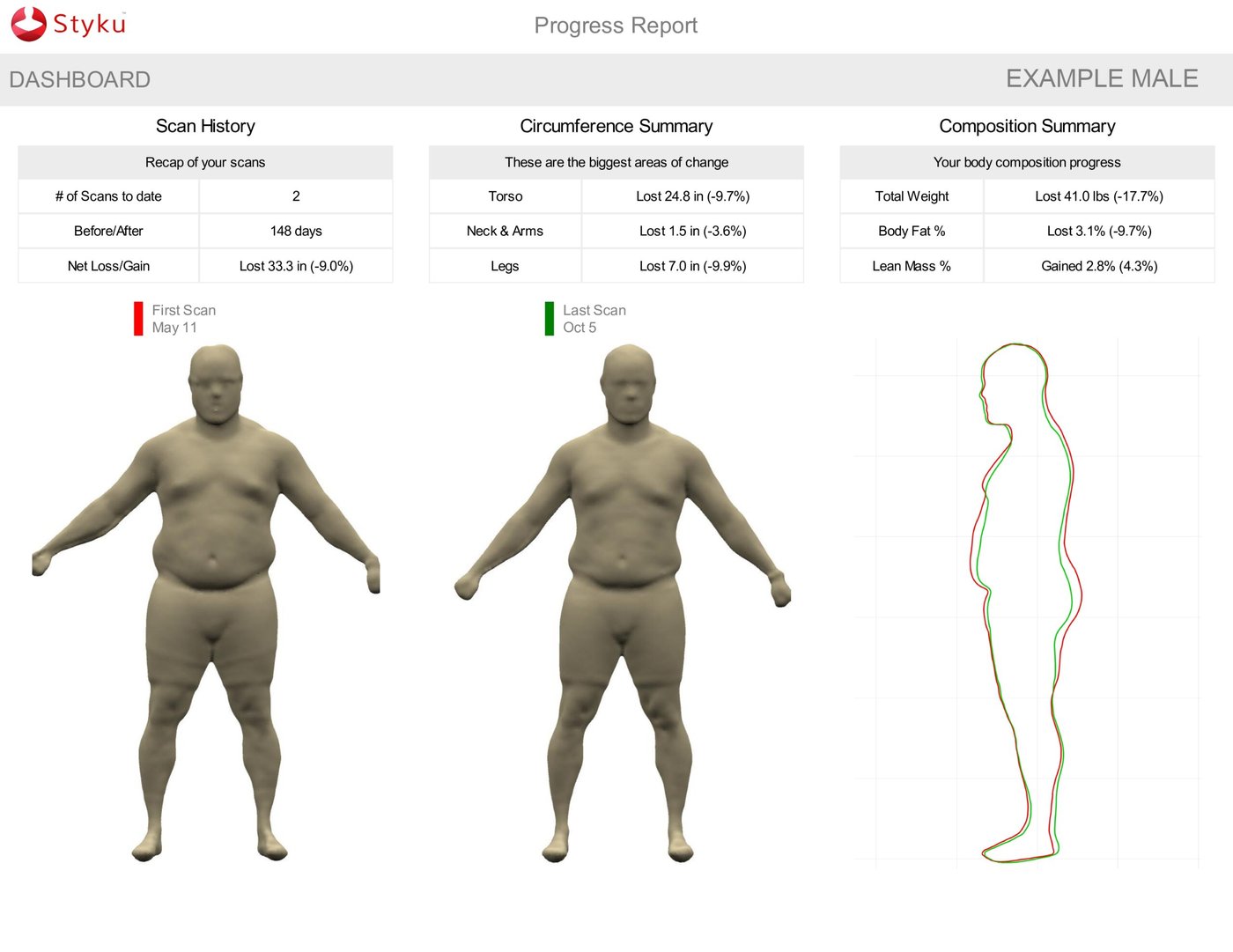 Example male 3D body scan progress report showing 41 lbs lost and 24.8 inches off torso over 148 days